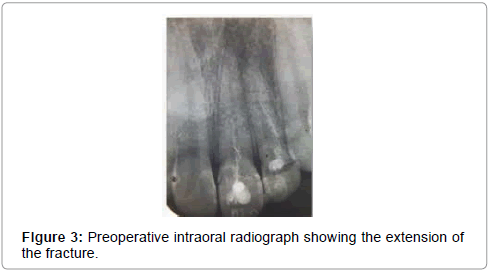 pediatric-dental-care-Preoperative-intraoral