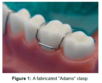 pediatric-dental-care-a-fabricated-adams