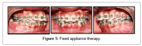 pediatric-dental-care-appliance