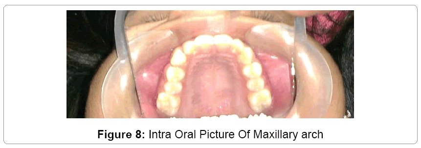 pediatric-dental-care-arch