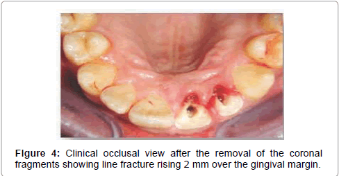 pediatric-dental-care-clinical-occlusal