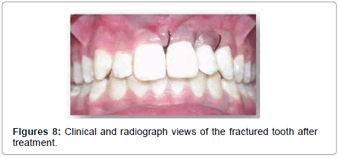 pediatric-dental-care-clinical-radiograph