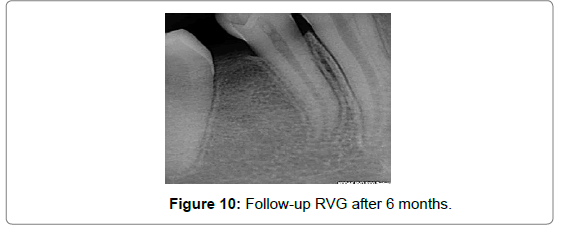 pediatric-dental-care-follow-up