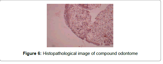 pediatric-dental-care-histopathological