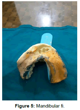pediatric-dental-care-mandibular