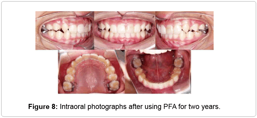 pediatric-dental-care-photographs