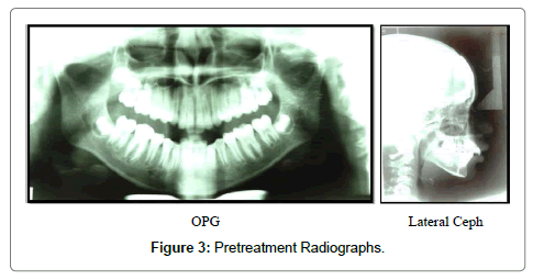 pediatric-dental-care-radiographs