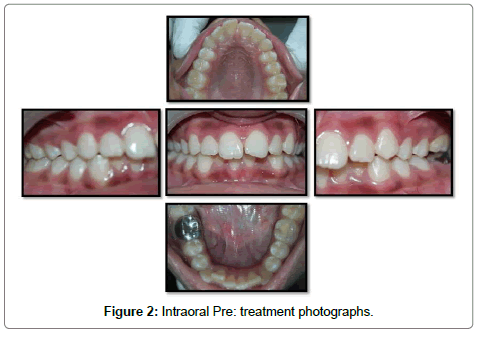 pediatric-dental-care-treatment