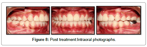 pediatric-dental-care-treatment