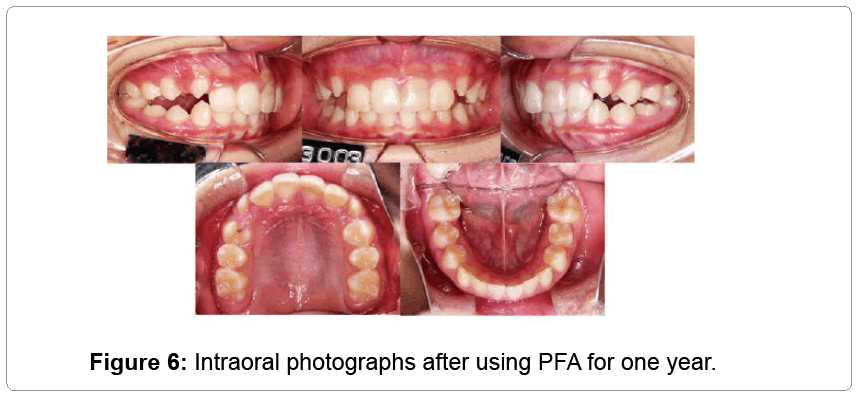 pediatric-dental-care-year