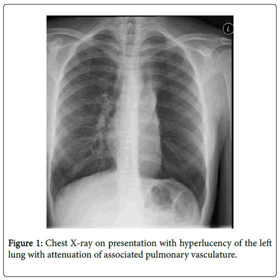 pediatric-medicine-chest-x-ray-presentation