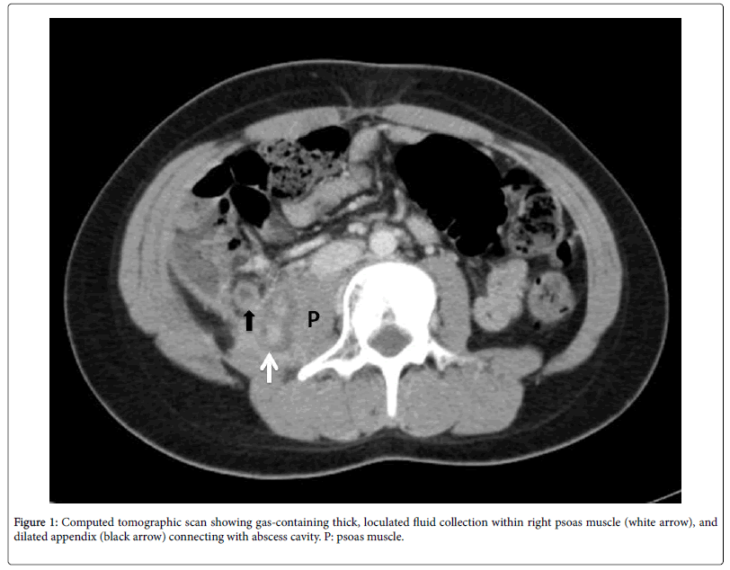 pediatric-medicine-computed-tomographic-scan