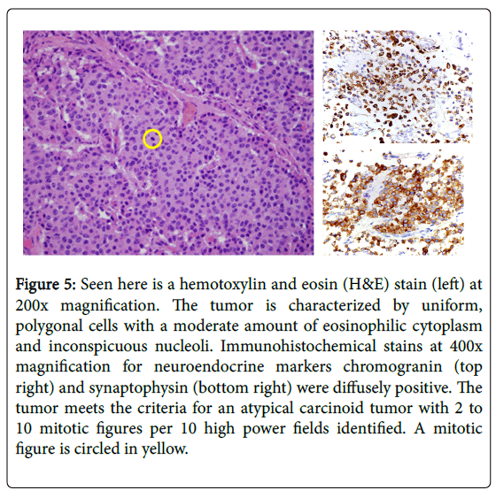 pediatric-medicine-hemotoxylin-and-eosin