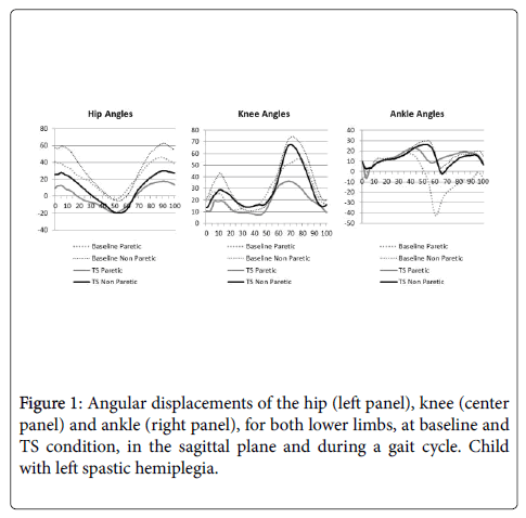 pediatric-neurological-disorders-displacements