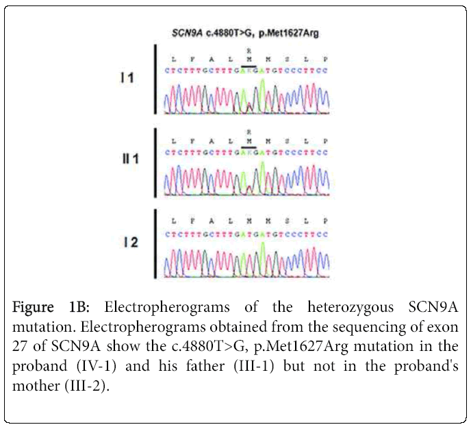 pediatric-neurosciences-Electropherograms