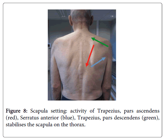 physical-medicine-rehabilitation-activity-Trapezius
