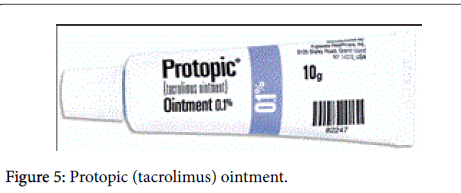 Protopic Tacrolimus Ointment Vitiligo