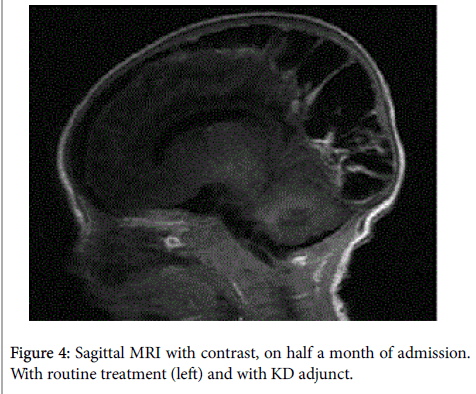 pregnancy-and-child-health-Sagittal-MRI