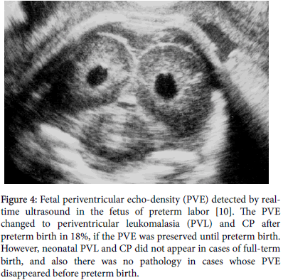 pregnancy-child-health-echo-density-realtime