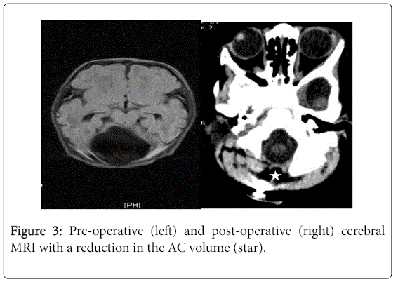 pregnancy-child-health-post-operative