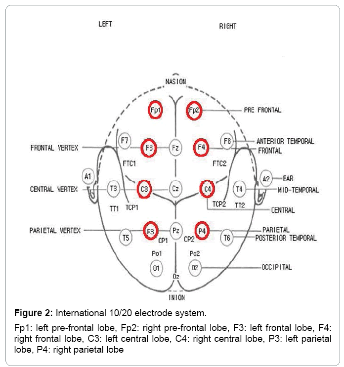 lead placement for neuromuscular interferential for sex Loud gay anal sex tubes