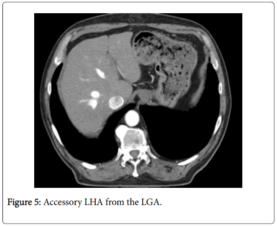 radiology-Accessory-LHA