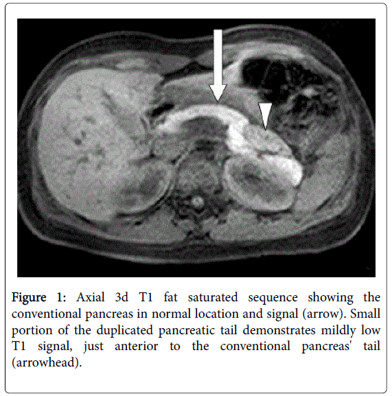 radiology-Axial-3d