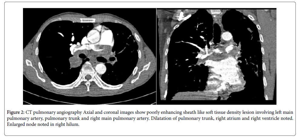 radiology-CT-pulmonary-angiography