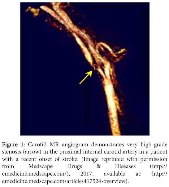 radiology-Carotid-MR-angiogram
