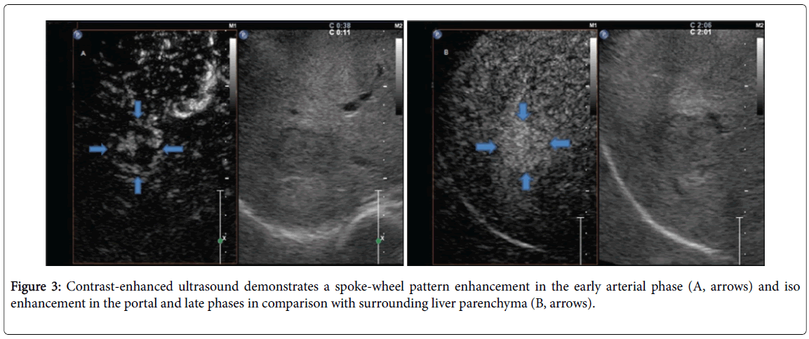 radiology-Contrast-enhanced