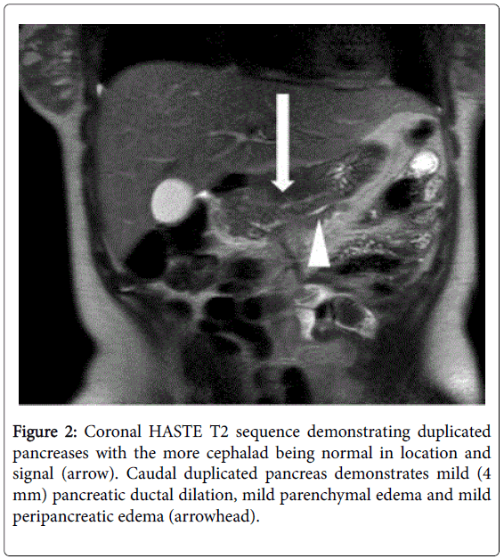 radiology-Coronal-HASTE