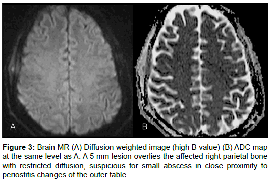 radiology-Diffusion-weighted-image