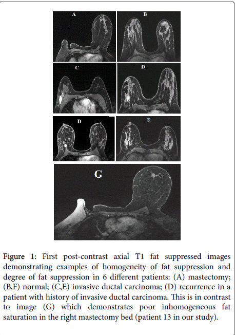 radiology-First-post-contrast