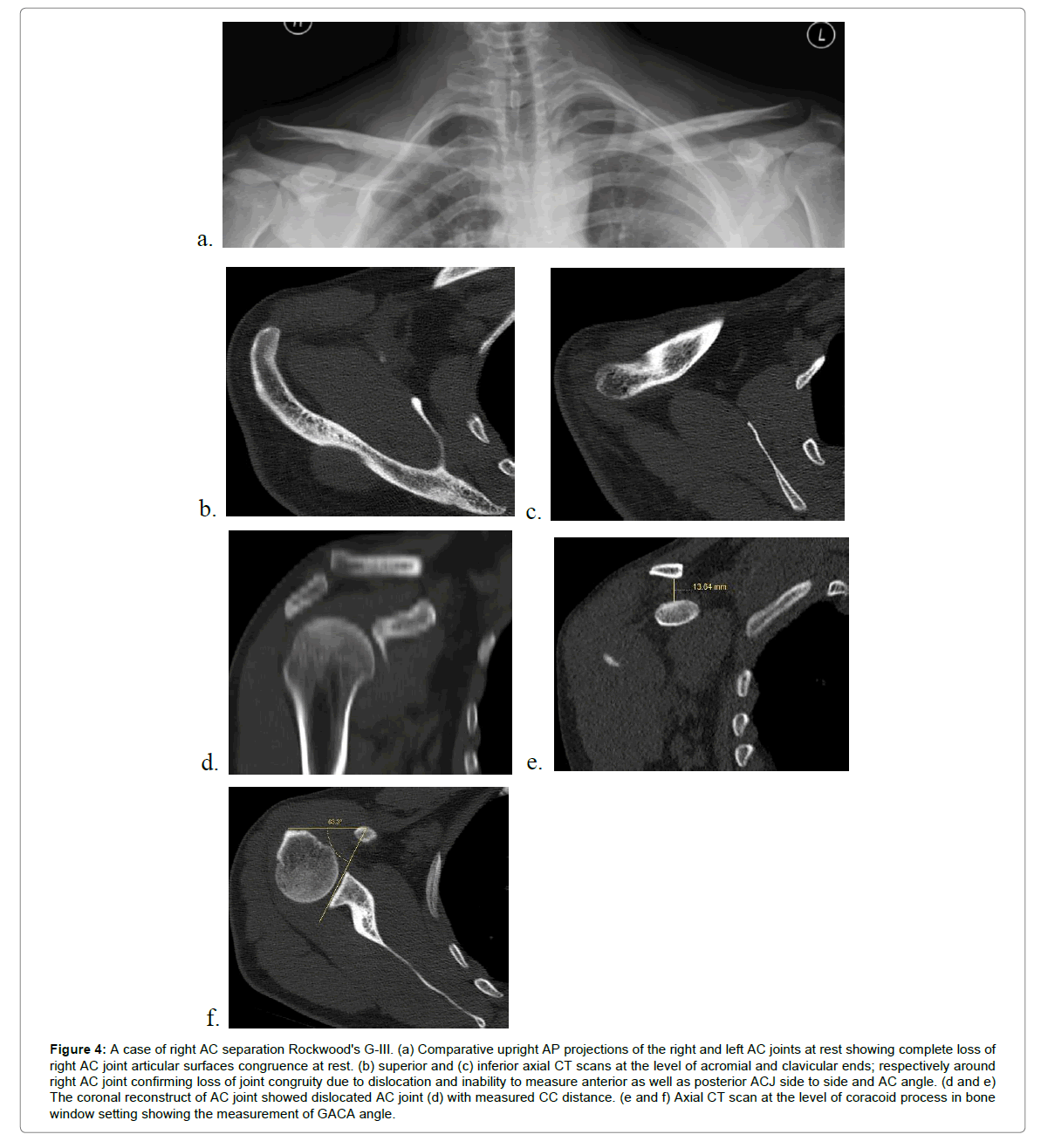 radiology-GACA-angle