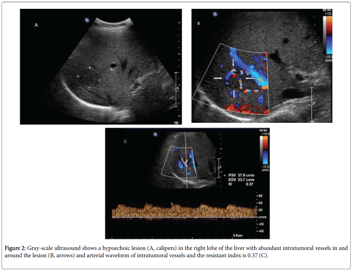 radiology-Gray-scale-ultrasound