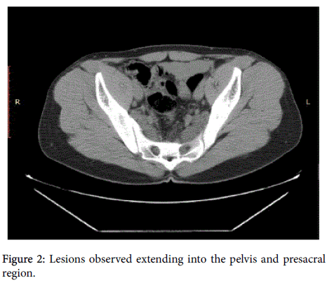 radiology-Lesions-observed