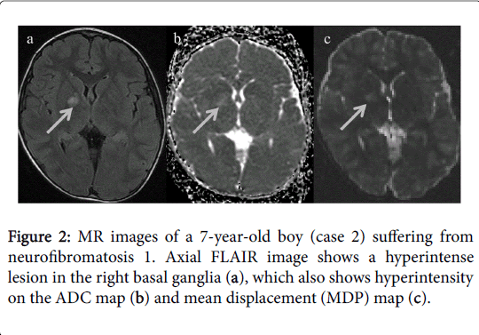 radiology-MR-images