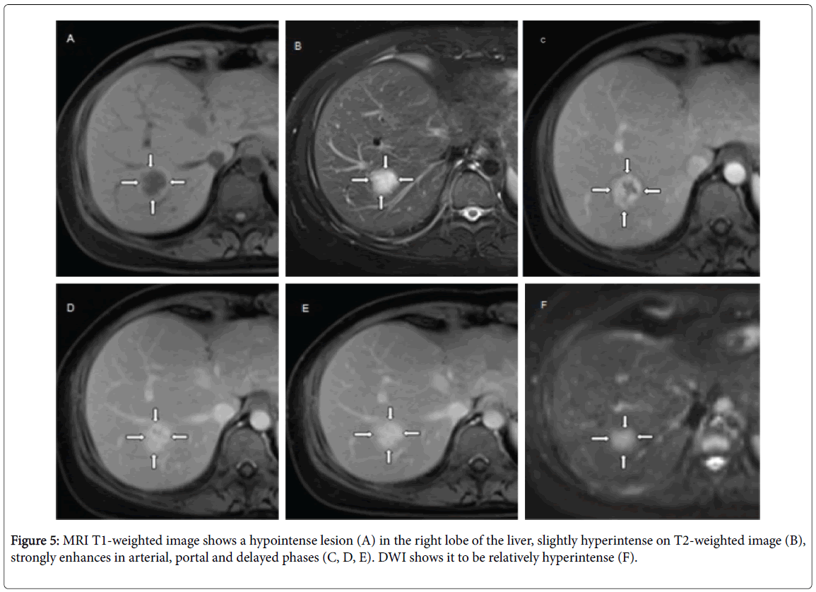 radiology-MRI-T1-weighted