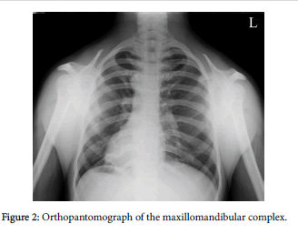 radiology-Orthopantomograph-maxillomandibular-complex