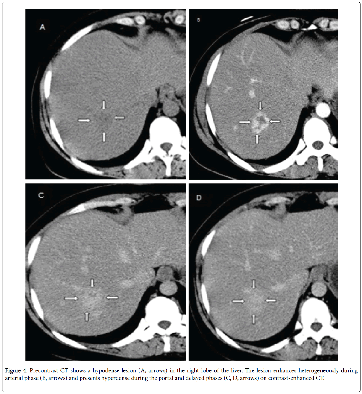 radiology-Precontrast-CT
