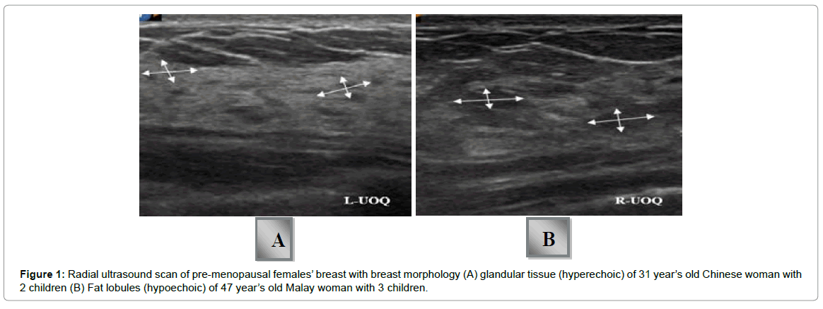 radiology-Radial-ultrasound