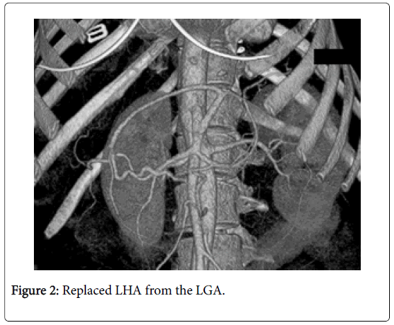 radiology-Replaced-LHA