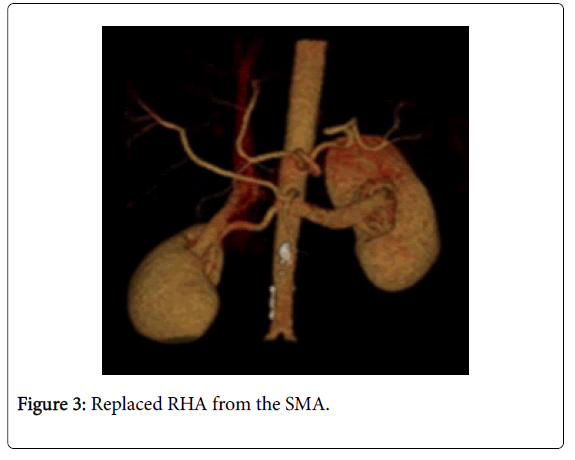radiology-Replaced-RHA