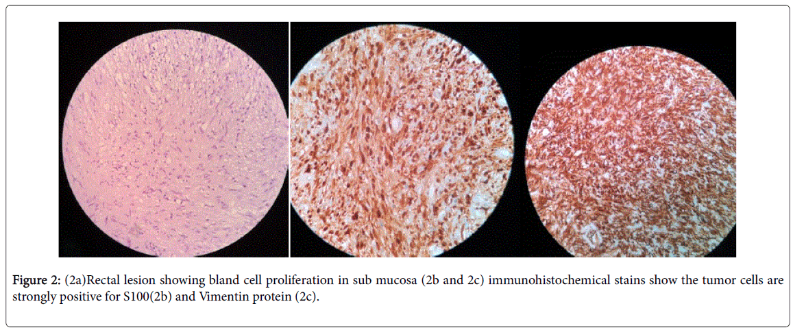 radiology-Vimentin-protein
