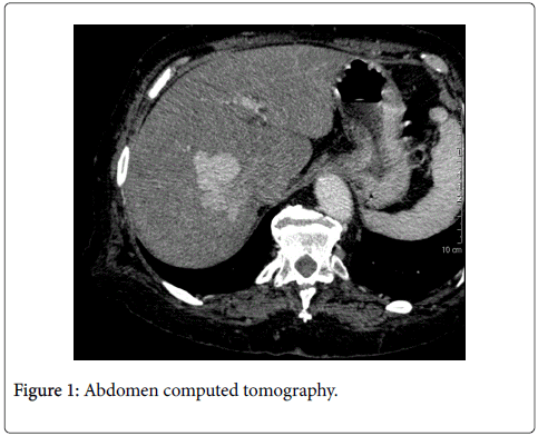 radiology-abdomen-computed-tomography