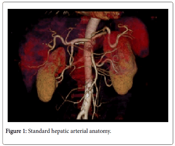 radiology-arterial-anatomy