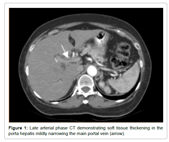 radiology-arterial-phase