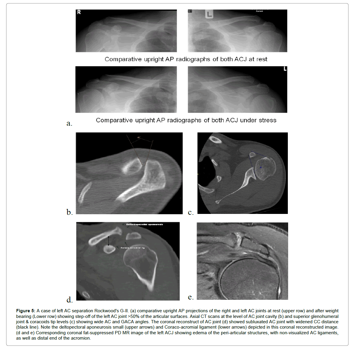 radiology-articular-surfaces
