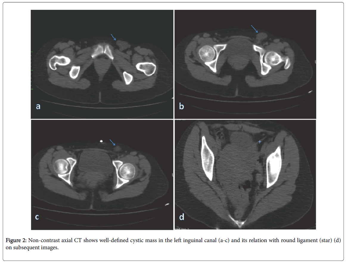 radiology-axial-CT