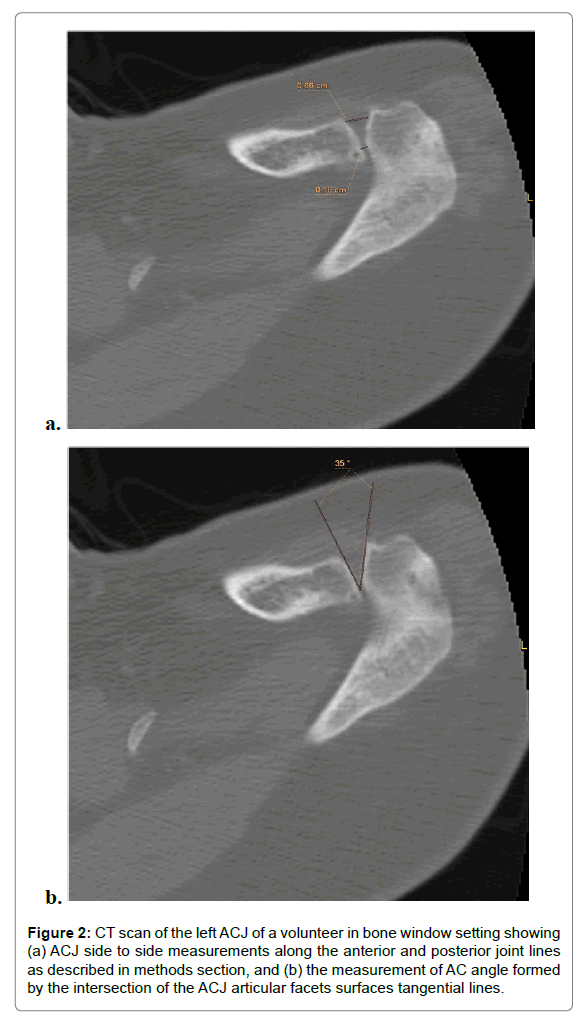 radiology-bone-window
